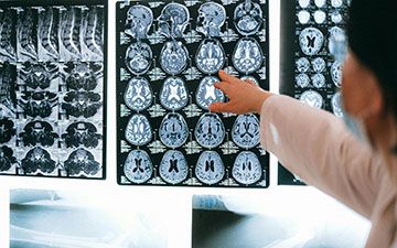 How to Navigate School Re-Entry Plans After Pediatric Radiation Therapy